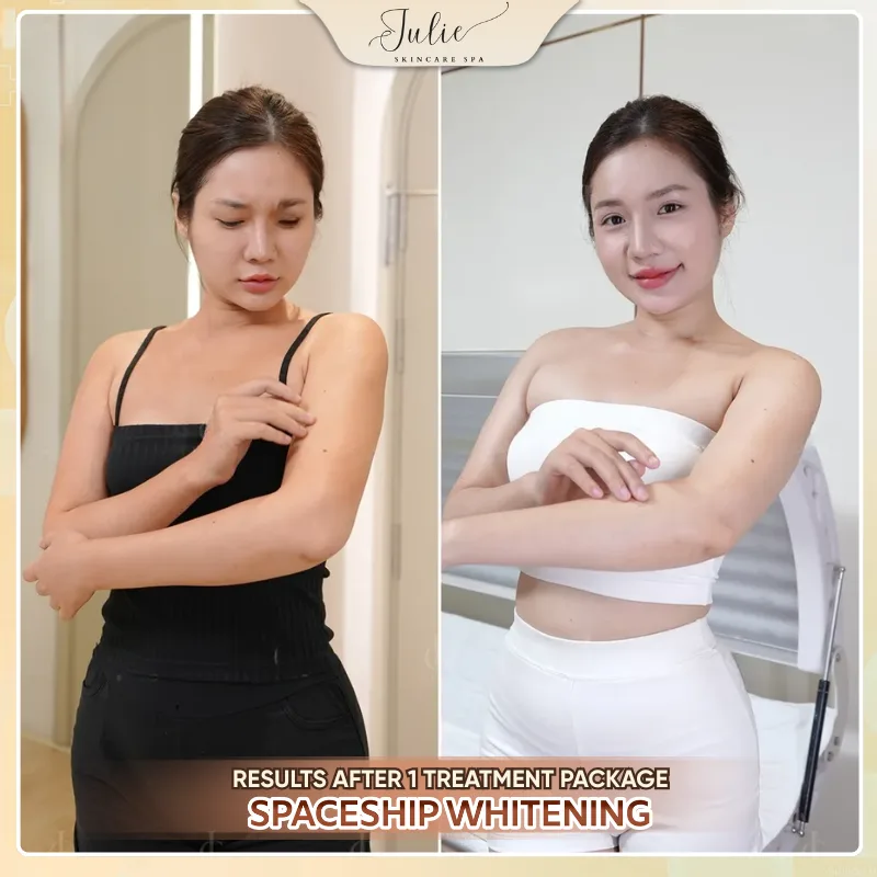 AVT TRANG 1